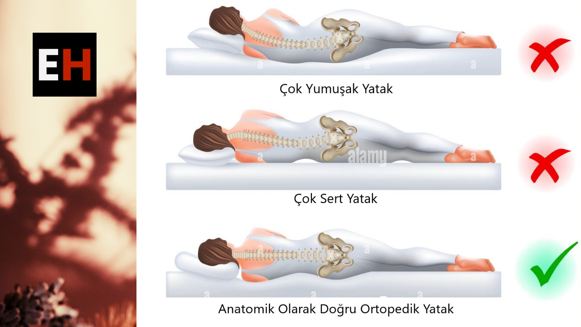 ortopedik yatak tavsiyesi